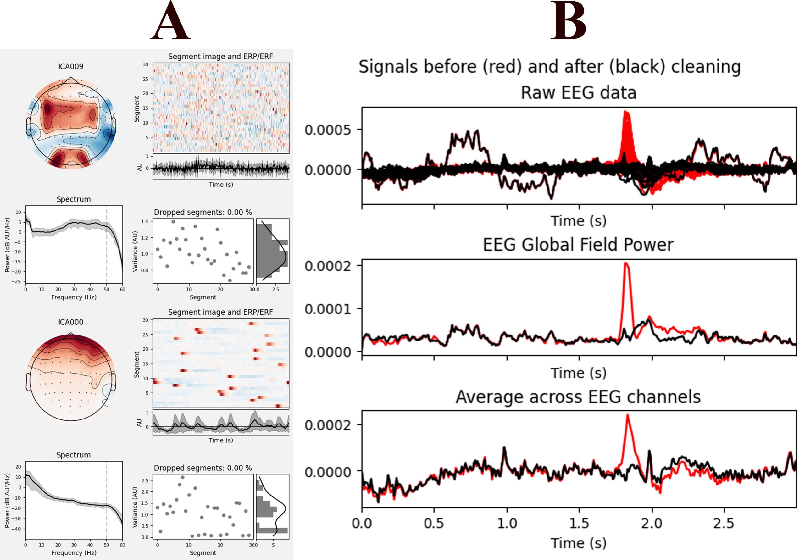 EEG Signal Processing
